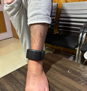 J&K Police starts using GPS tracker anklets to monitor criminals on bail | J&K Police starts using GPS tracker anklets to monitor criminals on bail