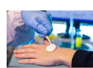 New Vitamin C-rich bandage to boost burn healing | New Vitamin C-rich bandage to boost burn healing New Vitamin C-rich bandage to boost burn healing | New Vitamin C-rich bandage to boost burn healing