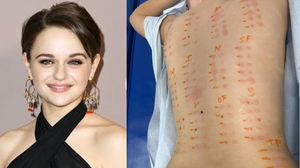 Joey King shares results of allergy test, says she's pretty much allergic to everything | Joey King shares results of allergy test, says she's pretty much allergic to everything