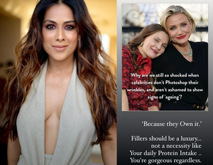 Nia Sharma: Fillers should be a luxury not necessity like your daily protein intake | Nia Sharma: Fillers should be a luxury not necessity like your daily protein intake Nia Sharma: Fillers should be a luxury not necessity like your daily protein intake | Nia Sharma: Fillers should be a luxury not necessity like your daily protein intake