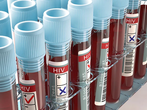 Philippines tallies 55 new HIV cases daily | Philippines tallies 55 new HIV cases daily