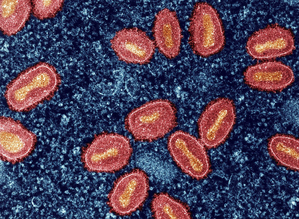 Mpox does not easily spread through air: US CDC | Mpox does not easily spread through air: US CDC Mpox does not easily spread through air: US CDC | Mpox does not easily spread through air: US CDC
