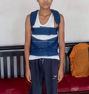 Complex 5-hour-long spine surgery gives Manipur boy a new lease of life | Complex 5-hour-long spine surgery gives Manipur boy a new lease of life Complex 5-hour-long spine surgery gives Manipur boy a new lease of life | Complex 5-hour-long spine surgery gives Manipur boy a new lease of life