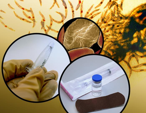 1st malaria vaccine offers protection for pregnant women | 1st malaria vaccine offers protection for pregnant women 1st malaria vaccine offers protection for pregnant women | 1st malaria vaccine offers protection for pregnant women