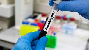 Philippines detects 3 more Mpox cases | Philippines detects 3 more Mpox cases Philippines detects 3 more Mpox cases | Philippines detects 3 more Mpox cases