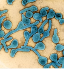 Marburg virus outbreak: Rwanda to begin trials for vaccine to fight fatal virus | Marburg virus outbreak: Rwanda to begin trials for vaccine to fight fatal virus Marburg virus outbreak: Rwanda to begin trials for vaccine to fight fatal virus | Marburg virus outbreak: Rwanda to begin trials for vaccine to fight fatal virus