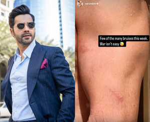 Varun Dhawan showcases ‘few of the many bruises’ he sustained | Varun Dhawan showcases ‘few of the many bruises’ he sustained Varun Dhawan showcases ‘few of the many bruises’ he sustained | Varun Dhawan showcases ‘few of the many bruises’ he sustained