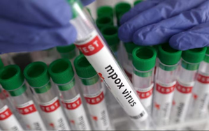 Mpox Clade 1b more infectious, increases risk of miscarriage: Study | Mpox Clade 1b more infectious, increases risk of miscarriage: Study