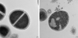 Human body's protein recycling system fights bacteria like antibiotics: Study | Human body's protein recycling system fights bacteria like antibiotics: Study Human body's protein recycling system fights bacteria like antibiotics: Study | Human body's protein recycling system fights bacteria like antibiotics: Study
