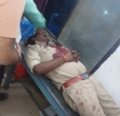 ASI killed, several cops injured in attack in MP's Mauganj | ASI killed, several cops injured in attack in MP's Mauganj ASI killed, several cops injured in attack in MP's Mauganj | ASI killed, several cops injured in attack in MP's Mauganj