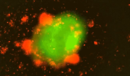 Ultrasound-activated CAR T-cell therapy to enable long-lasting tumour destruction | Ultrasound-activated CAR T-cell therapy to enable long-lasting tumour destruction Ultrasound-activated CAR T-cell therapy to enable long-lasting tumour destruction | Ultrasound-activated CAR T-cell therapy to enable long-lasting tumour destruction