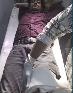 Notorious drug peddler injured in police encounter in Bhubaneswar | Notorious drug peddler injured in police encounter in Bhubaneswar Notorious drug peddler injured in police encounter in Bhubaneswar | Notorious drug peddler injured in police encounter in Bhubaneswar