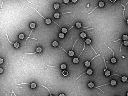 Hidden virus found common in germs that cause pneumonia: Study | Hidden virus found common in germs that cause pneumonia: Study Hidden virus found common in germs that cause pneumonia: Study | Hidden virus found common in germs that cause pneumonia: Study