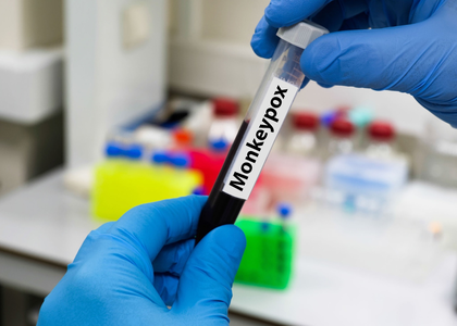 Malawi confirms sixth mpox case | Malawi confirms sixth mpox case Malawi confirms sixth mpox case | Malawi confirms sixth mpox case