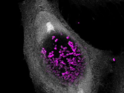 Researchers find molecule to kill sexually transmitted chlamydia | Researchers find molecule to kill sexually transmitted chlamydia Researchers find molecule to kill sexually transmitted chlamydia | Researchers find molecule to kill sexually transmitted chlamydia