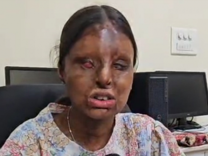 Tragedy into triumph: Chandigarh acid attack survivor scores 95.6 pc in CBSE Class 12 | Tragedy into triumph: Chandigarh acid attack survivor scores 95.6 pc in CBSE Class 12 Tragedy into triumph: Chandigarh acid attack survivor scores 95.6 pc in CBSE Class 12 | Tragedy into triumph: Chandigarh acid attack survivor scores 95.6 pc in CBSE Class 12