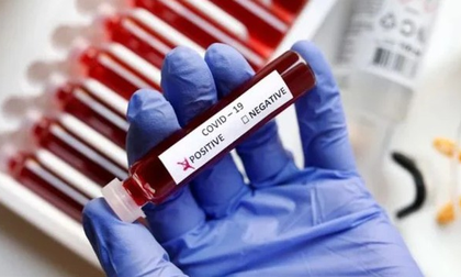 K'taka Health Ministry issues advisory, says sharp rise in Covid cases in Bengaluru in 20 days | K'taka Health Ministry issues advisory, says sharp rise in Covid cases in Bengaluru in 20 days K'taka Health Ministry issues advisory, says sharp rise in Covid cases in Bengaluru in 20 days | K'taka Health Ministry issues advisory, says sharp rise in Covid cases in Bengaluru in 20 days
