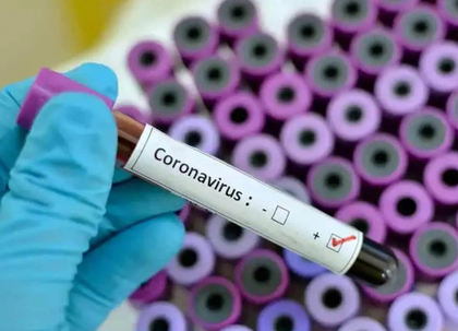 K'taka govt directs authorities to stock up Covid-19 testing kits | K'taka govt directs authorities to stock up Covid-19 testing kits K'taka govt directs authorities to stock up Covid-19 testing kits | K'taka govt directs authorities to stock up Covid-19 testing kits