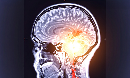 Oral, gut bacteria worsening Parkinson's disease: Study | Oral, gut bacteria worsening Parkinson's disease: Study Oral, gut bacteria worsening Parkinson's disease: Study | Oral, gut bacteria worsening Parkinson's disease: Study