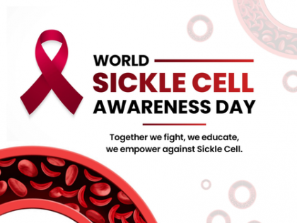 5.72 crore people screened for Sickle Cell Disease: Centre | 5.72 crore people screened for Sickle Cell Disease: Centre 5.72 crore people screened for Sickle Cell Disease: Centre | 5.72 crore people screened for Sickle Cell Disease: Centre