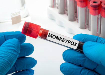 Over 1,800 mpox deaths reported in Africa amid health emergencies | Over 1,800 mpox deaths reported in Africa amid health emergencies Over 1,800 mpox deaths reported in Africa amid health emergencies | Over 1,800 mpox deaths reported in Africa amid health emergencies