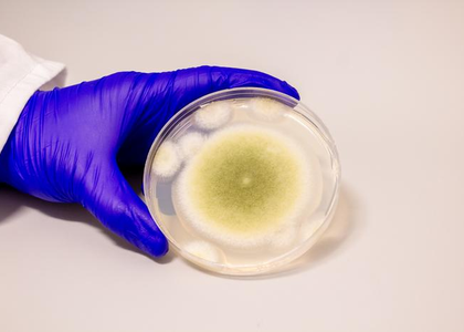 Researchers turn toxic fungus into potent anti-cancer compound | Researchers turn toxic fungus into potent anti-cancer compound Researchers turn toxic fungus into potent anti-cancer compound | Researchers turn toxic fungus into potent anti-cancer compound