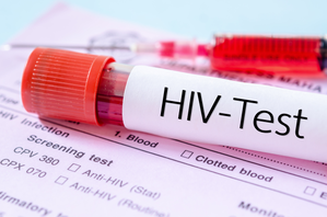 Zimbabwe records increase in AIDS-related deaths, says Health Ministry | Zimbabwe records increase in AIDS-related deaths, says Health Ministry Zimbabwe records increase in AIDS-related deaths, says Health Ministry | Zimbabwe records increase in AIDS-related deaths, says Health Ministry