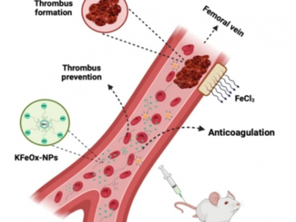 IIT-BHU bioengineers develop nanoparticles to stop blood clotting | IIT-BHU bioengineers develop nanoparticles to stop blood clotting IIT-BHU bioengineers develop nanoparticles to stop blood clotting | IIT-BHU bioengineers develop nanoparticles to stop blood clotting