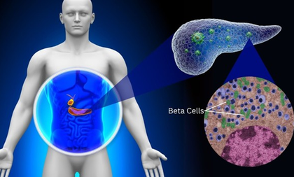 IIT Bombay study finds protein abundant in human body worsening diabetes | IIT Bombay study finds protein abundant in human body worsening diabetes IIT Bombay study finds protein abundant in human body worsening diabetes | IIT Bombay study finds protein abundant in human body worsening diabetes