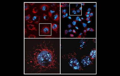 Study decodes why promising cancer treatments trigger serious side effects | Study decodes why promising cancer treatments trigger serious side effects Study decodes why promising cancer treatments trigger serious side effects | Study decodes why promising cancer treatments trigger serious side effects