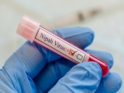 Kerala: 32-year-old man tests positive for Nipah | Kerala: 32-year-old man tests positive for Nipah Kerala: 32-year-old man tests positive for Nipah | Kerala: 32-year-old man tests positive for Nipah