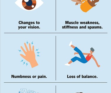 Multiple sclerosis may emerge a decade before neurological symptoms begin to appear | Multiple sclerosis may emerge a decade before neurological symptoms begin to appear Multiple sclerosis may emerge a decade before neurological symptoms begin to appear | Multiple sclerosis may emerge a decade before neurological symptoms begin to appear