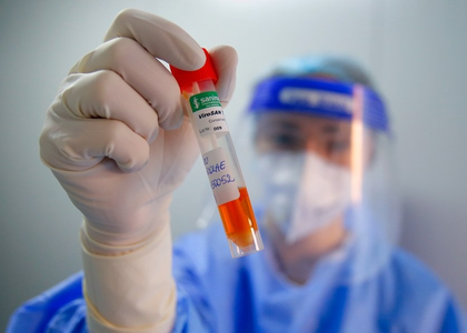 Romania reports 1,703 new Covid cases, seven deaths in July | Romania reports 1,703 new Covid cases, seven deaths in July Romania reports 1,703 new Covid cases, seven deaths in July | Romania reports 1,703 new Covid cases, seven deaths in July