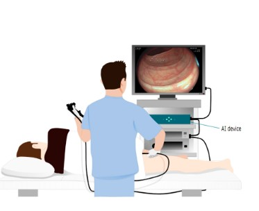 AI-assisted colonoscopies may raise deskilling risk among doctors: The Lancet | AI-assisted colonoscopies may raise deskilling risk among doctors: The Lancet AI-assisted colonoscopies may raise deskilling risk among doctors: The Lancet | AI-assisted colonoscopies may raise deskilling risk among doctors: The Lancet