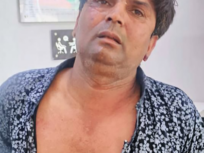 Delhi CM assault: Rajesh Khimji to be produced in court today | Delhi CM assault: Rajesh Khimji to be produced in court today