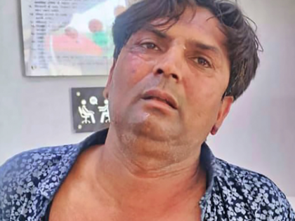 Delhi CM attack case deepens; police arrest Rajesh’s associate Tahseen in alleged murder plot | Delhi CM attack case deepens; police arrest Rajesh’s associate Tahseen in alleged murder plot Delhi CM attack case deepens; police arrest Rajesh’s associate Tahseen in alleged murder plot | Delhi CM attack case deepens; police arrest Rajesh’s associate Tahseen in alleged murder plot