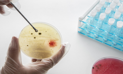 Airborne pathogens behind lung, gut infections 2x more in high-populated regions: Study | Airborne pathogens behind lung, gut infections 2x more in high-populated regions: Study Airborne pathogens behind lung, gut infections 2x more in high-populated regions: Study | Airborne pathogens behind lung, gut infections 2x more in high-populated regions: Study