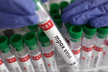 Uganda's mpox cases hit 8,001 as infections decline | Uganda's mpox cases hit 8,001 as infections decline Uganda's mpox cases hit 8,001 as infections decline | Uganda's mpox cases hit 8,001 as infections decline