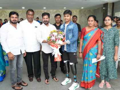 Telangana student who lost both legs after being pushed off train get prosthetic limbs | Telangana student who lost both legs after being pushed off train get prosthetic limbs