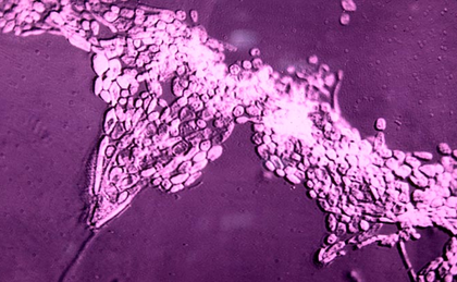 ICMR researchers develop new approach to tackle fungal pathogens | ICMR researchers develop new approach to tackle fungal pathogens ICMR researchers develop new approach to tackle fungal pathogens | ICMR researchers develop new approach to tackle fungal pathogens