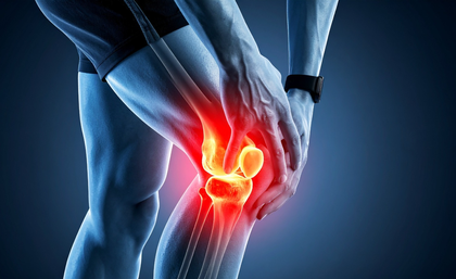 Study shows rheumatoid arthritis begins years before symptoms appear | Study shows rheumatoid arthritis begins years before symptoms appear