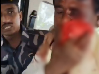 BJP MP Khagen Murmu brutally attacked in North Bengal, cars vandalised | BJP MP Khagen Murmu brutally attacked in North Bengal, cars vandalised