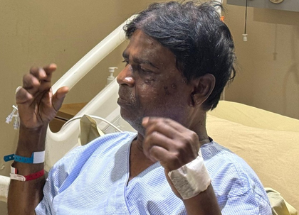 ‘Attackers planned to kill us’: Injured Bengal BJP MP | ‘Attackers planned to kill us’: Injured Bengal BJP MP ‘Attackers planned to kill us’: Injured Bengal BJP MP | ‘Attackers planned to kill us’: Injured Bengal BJP MP
