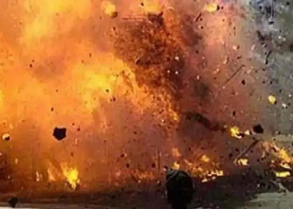 Hyderabad: At Least 47 People Injured During Diwali 2025 Celebrations Across the City | Hyderabad: At Least 47 People Injured During Diwali 2025 Celebrations Across the City Hyderabad: At Least 47 People Injured During Diwali 2025 Celebrations Across the City | Hyderabad: At Least 47 People Injured During Diwali 2025 Celebrations Across the City