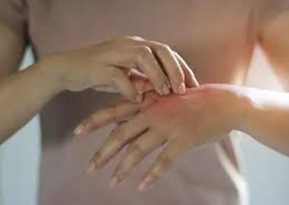 Vietnam's Ho Chi Minh City records surge in hand-foot-mouth disease cases | Vietnam's Ho Chi Minh City records surge in hand-foot-mouth disease cases