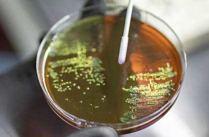 Why is antimicrobial resistance not just future threat, but a present reality | Why is antimicrobial resistance not just future threat, but a present reality Why is antimicrobial resistance not just future threat, but a present reality | Why is antimicrobial resistance not just future threat, but a present reality