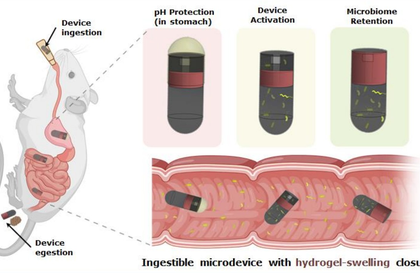 IIT Delhi, AIIMS’s new ingestible device can collect microbial samples from small intestine | IIT Delhi, AIIMS’s new ingestible device can collect microbial samples from small intestine IIT Delhi, AIIMS’s new ingestible device can collect microbial samples from small intestine | IIT Delhi, AIIMS’s new ingestible device can collect microbial samples from small intestine