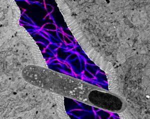 US researchers find gut bacteria that can help lose weight, boost metabolic health | US researchers find gut bacteria that can help lose weight, boost metabolic health US researchers find gut bacteria that can help lose weight, boost metabolic health | US researchers find gut bacteria that can help lose weight, boost metabolic health