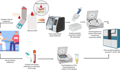 At-home blood tests can accurately detect key biomarkers of Alzheimer's | At-home blood tests can accurately detect key biomarkers of Alzheimer's At-home blood tests can accurately detect key biomarkers of Alzheimer's | At-home blood tests can accurately detect key biomarkers of Alzheimer's