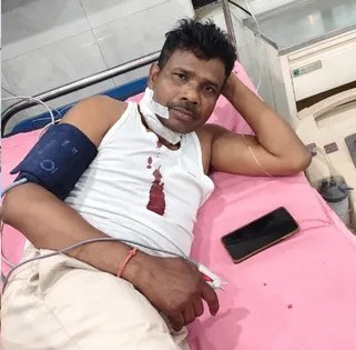 Excise team attacked during raid on illegal liquor unit in Jharkhand’s Chaibasa, officer injured | Excise team attacked during raid on illegal liquor unit in Jharkhand’s Chaibasa, officer injured Excise team attacked during raid on illegal liquor unit in Jharkhand’s Chaibasa, officer injured | Excise team attacked during raid on illegal liquor unit in Jharkhand’s Chaibasa, officer injured